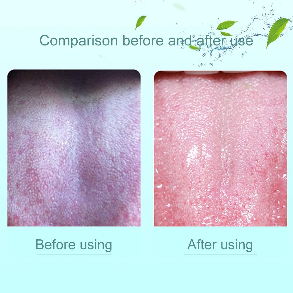 Tongue Scraper