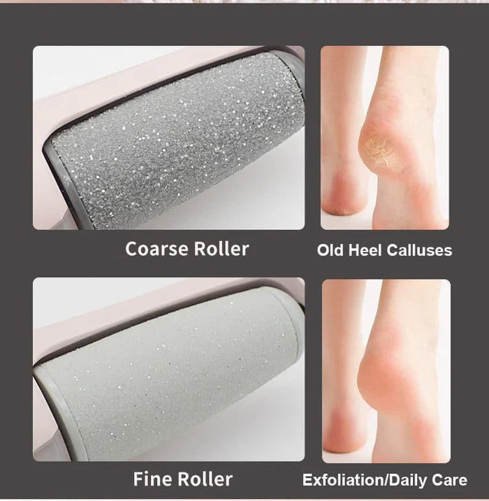 Foot File Callus