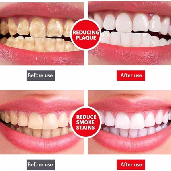 Sp-4 Ultra Whitening Toothpaste